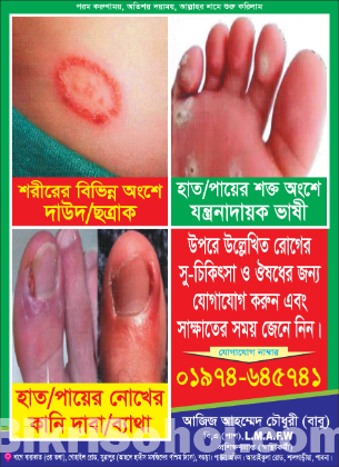 পায়ের ভাষি ও কেনি দাবা